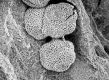 image of Chloranthistemon crossmanensis