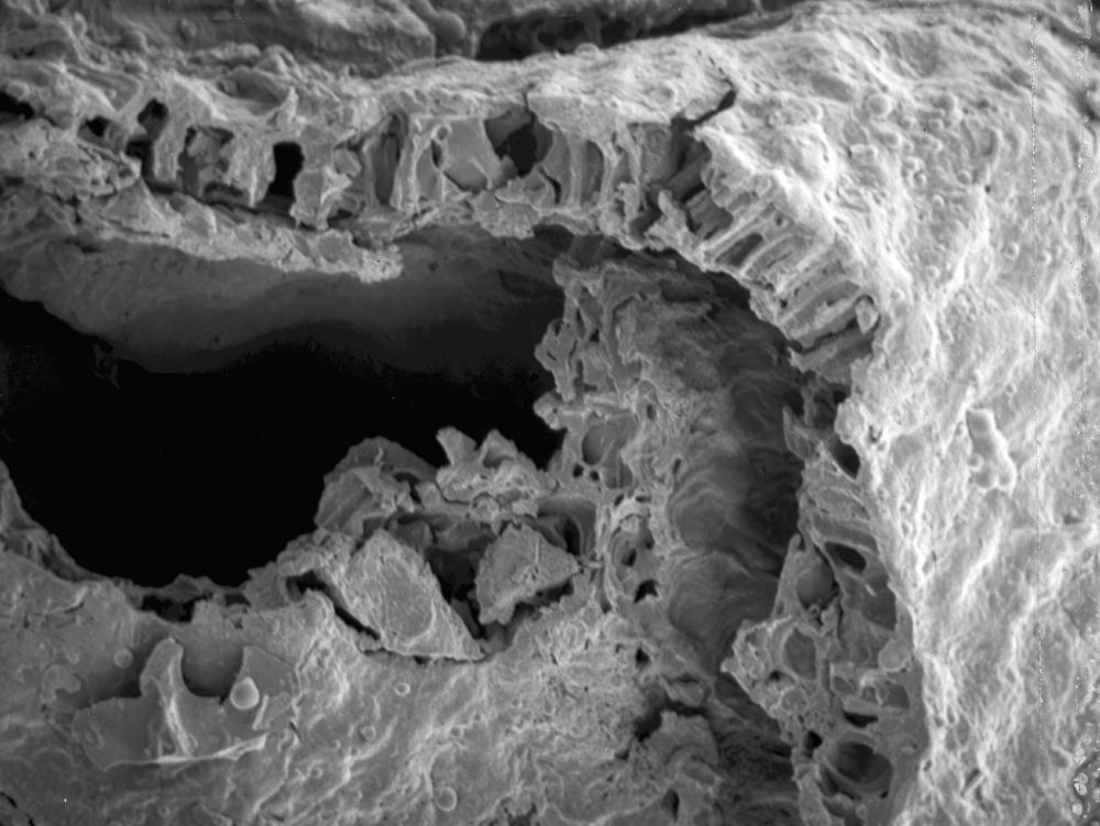 Triuridaceae Mabelia archaia