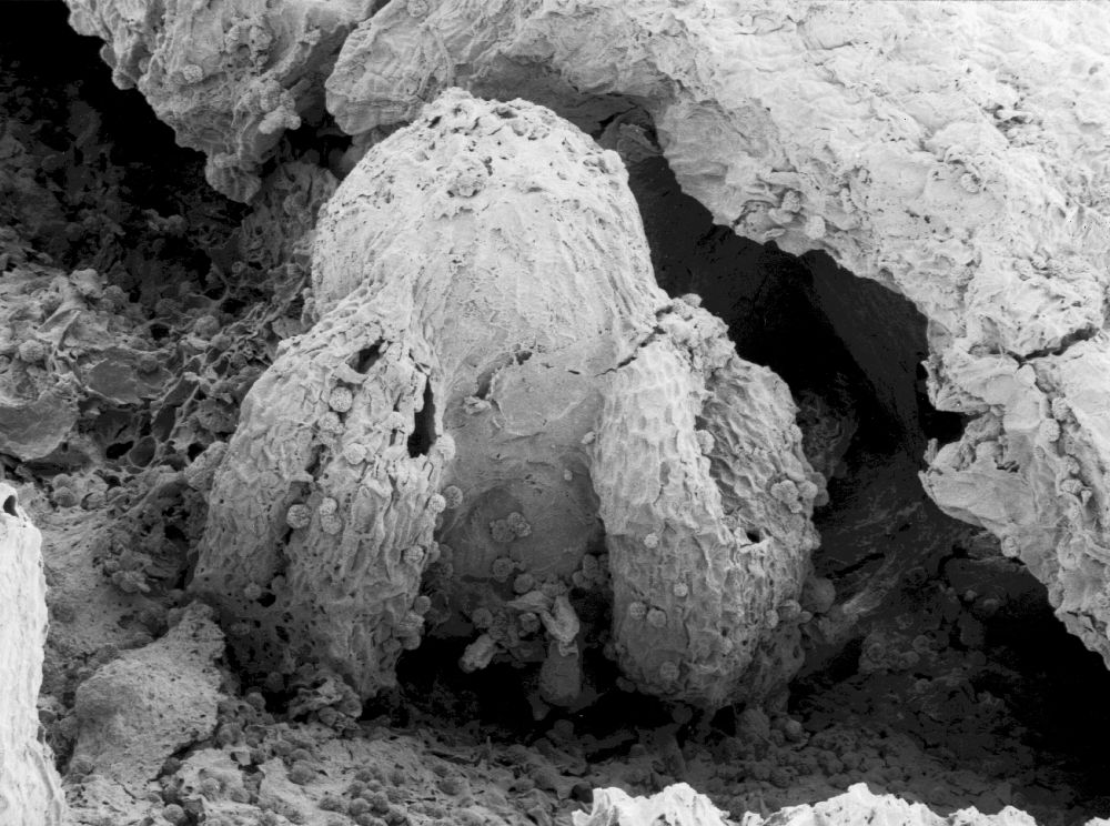 Triuridaceae Mabelia archaia