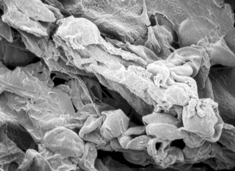 Triuridaceae Mabelia archaia