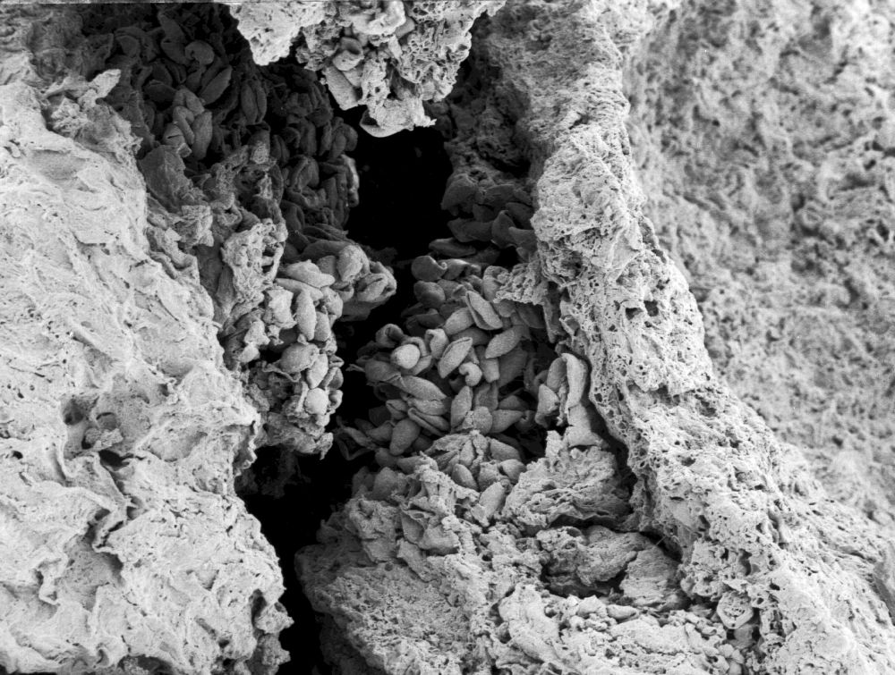 Triuridaceae Mabelia archaia