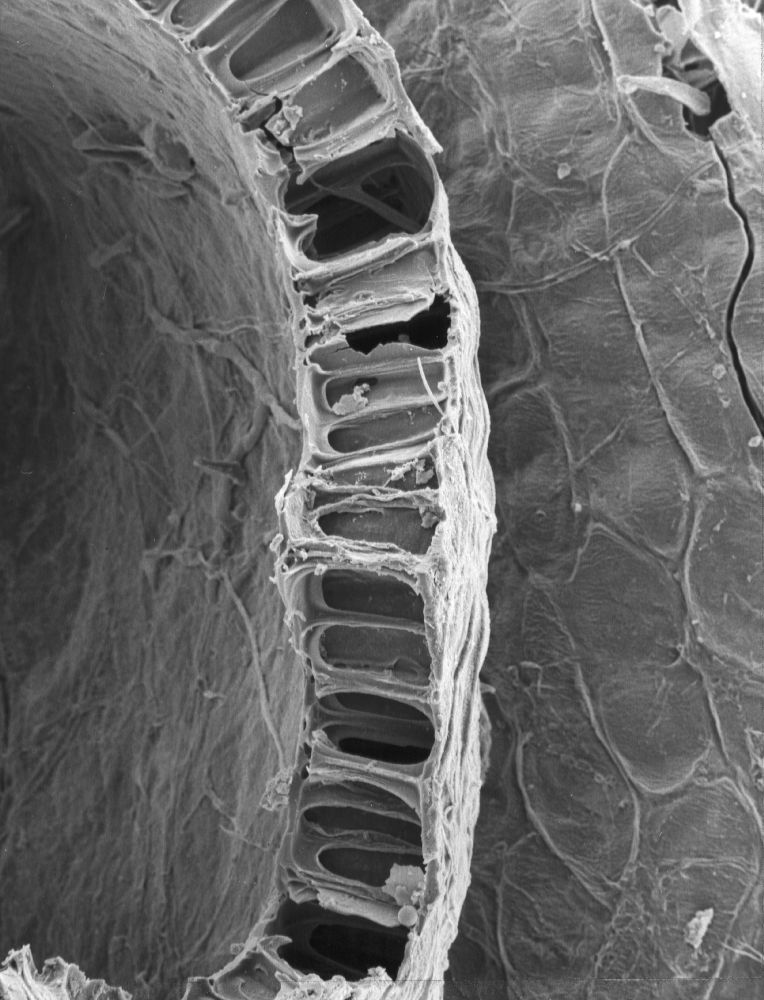 Triuridaceae Mabelia archaia