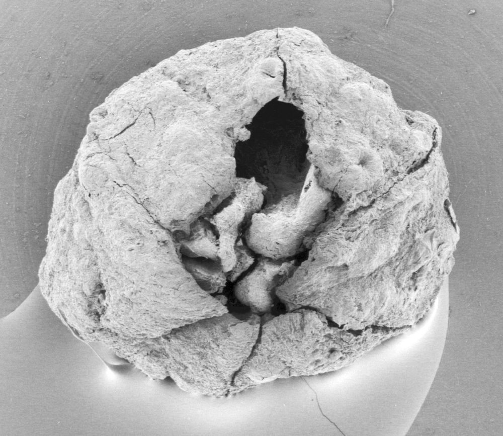 Triuridaceae Mabelia archaia