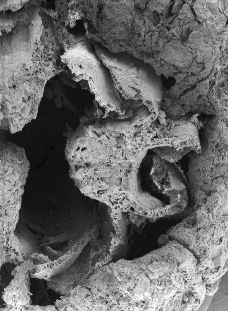 Triuridaceae Mabelia archaia