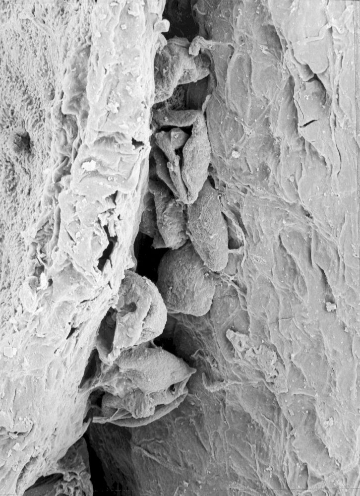 Triuridaceae Mabelia archaia