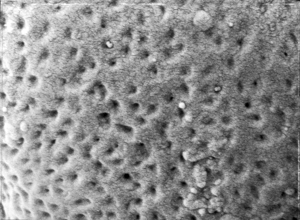 Triuridaceae Mabelia archaia