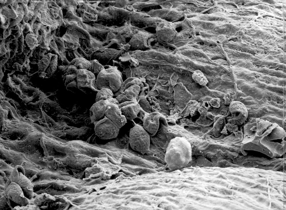 Triuridaceae Mabelia archaia