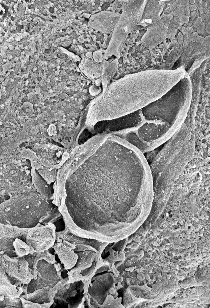 Triuridaceae Mabelia archaia