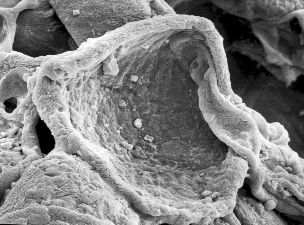 Triuridaceae Mabelia archaia