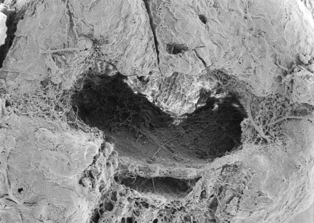 Triuridaceae Mabelia archaia