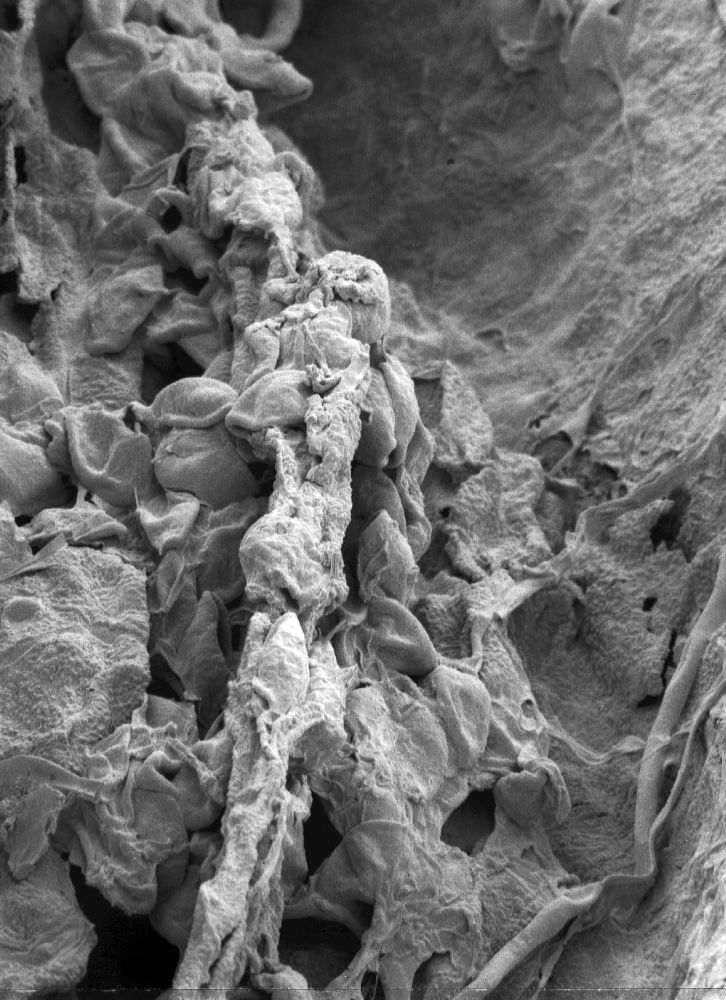 Triuridaceae Mabelia archaia