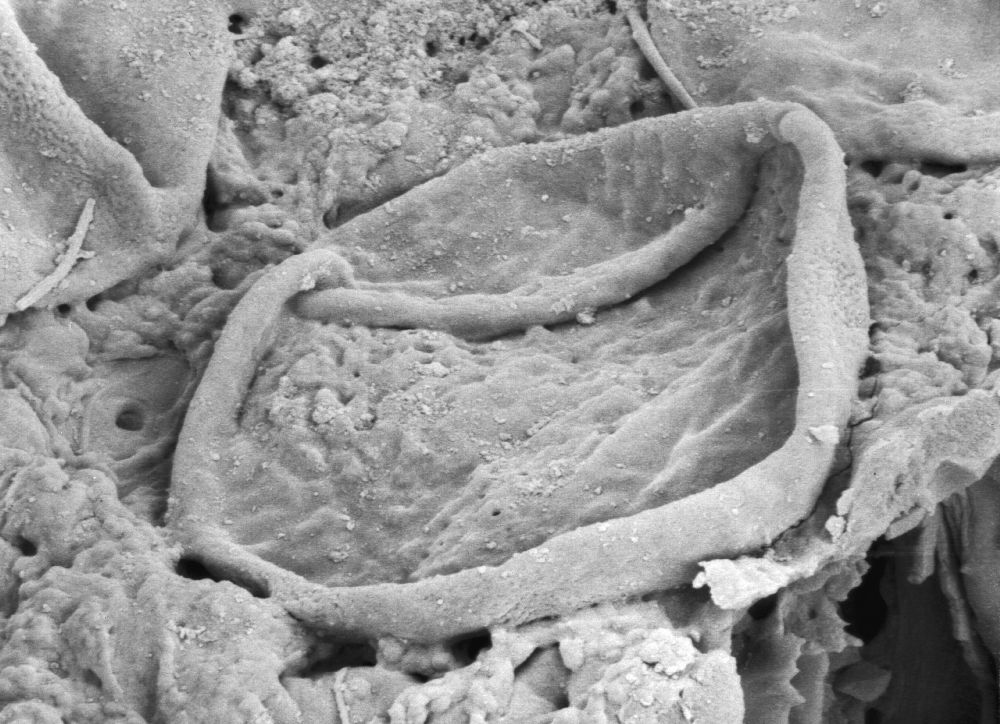 Triuridaceae Mabelia archaia