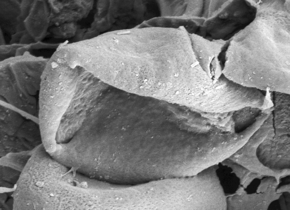 Triuridaceae Mabelia archaia