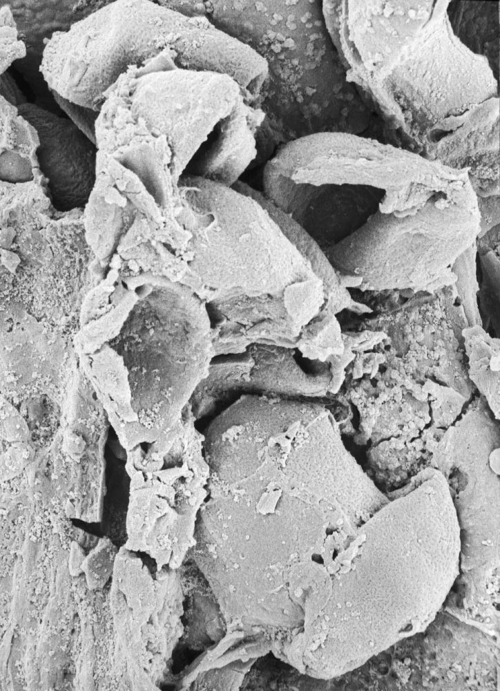 Triuridaceae Mabelia connatifila