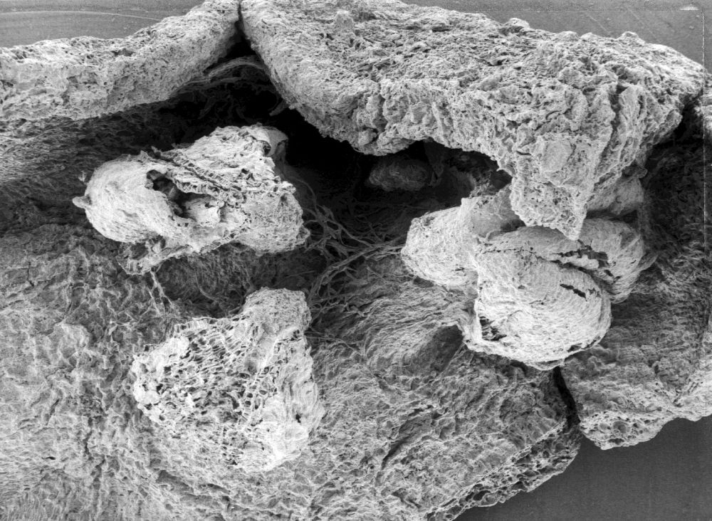 Triuridaceae Mabelia connatifila