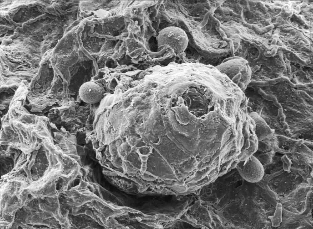 Triuridaceae Mabelia connatifila