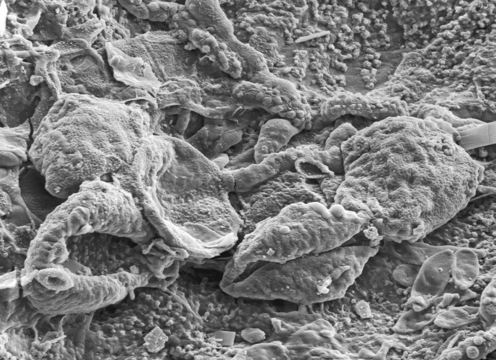 Triuridaceae Mabelia connatifila