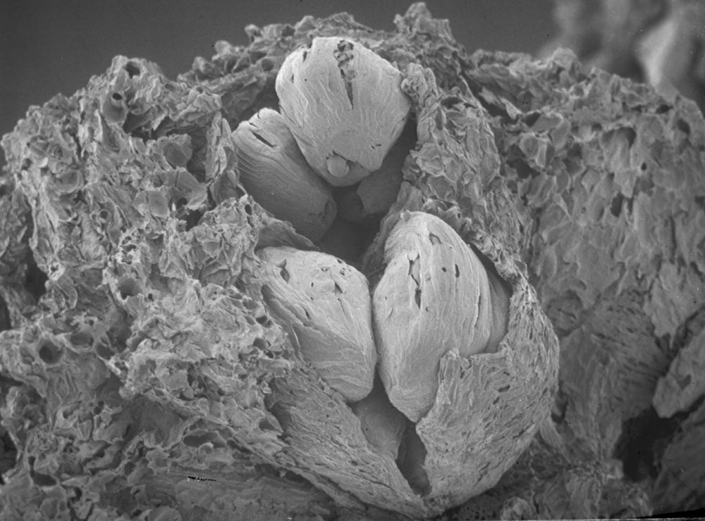 Saxifragales Microaltingia apocarpela