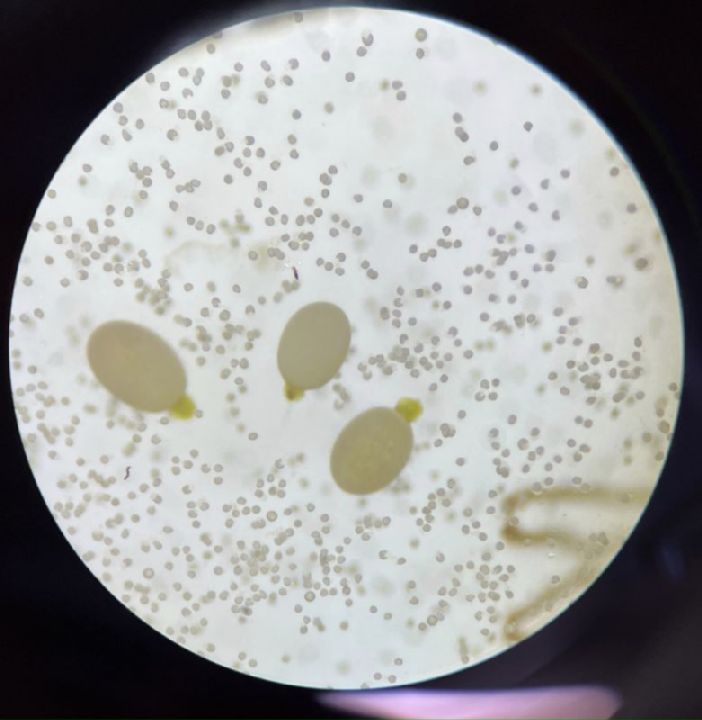 Marsileaceae Marsilea macropoda