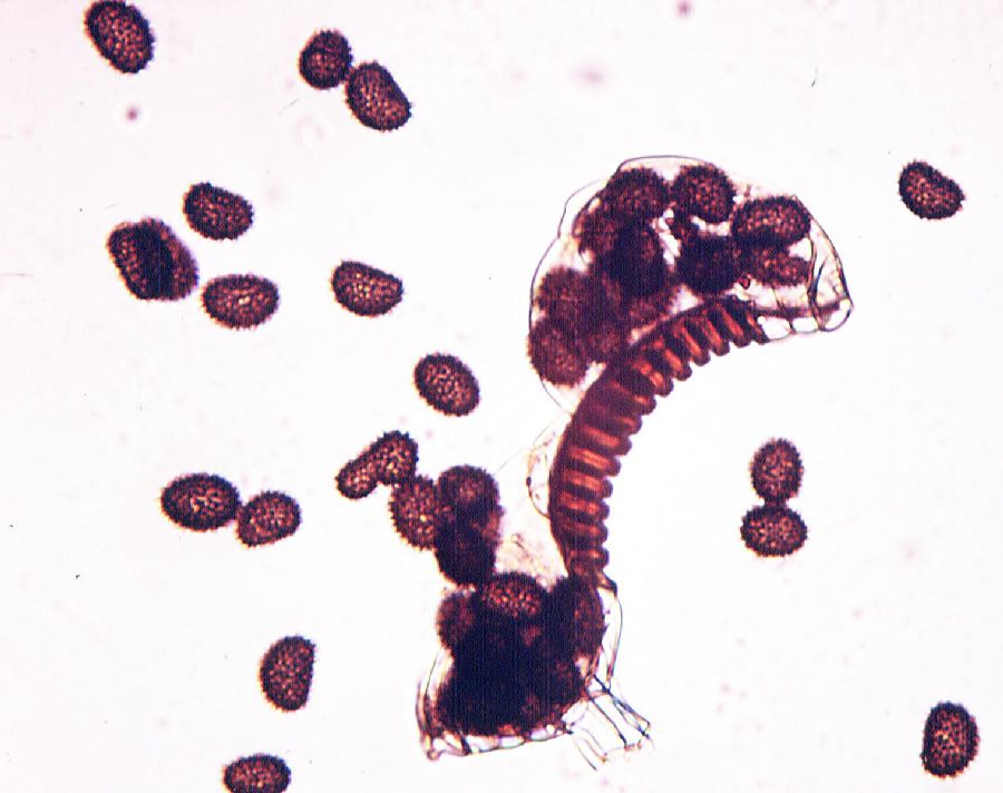 Cystopteridaceae Cystopteris tennesseensis